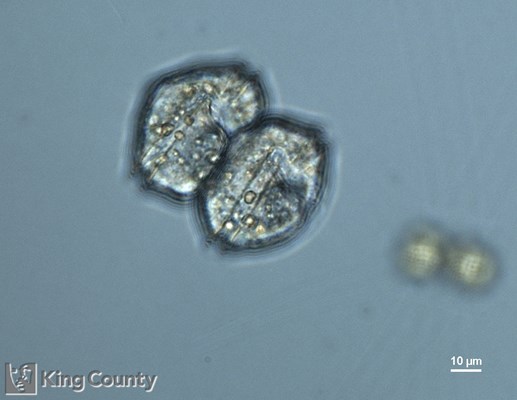 Photo of Alexandrium catenella